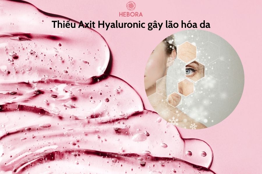 Thiếu axit Hyalorunic gây lão hóa da