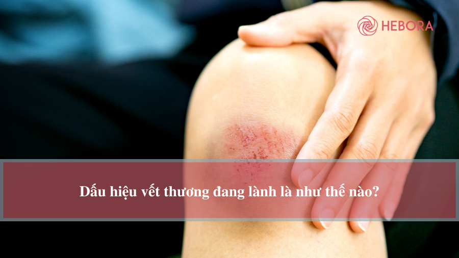 Có phải vùng da bị teo quắt là một trong những dấu hiệu của hoại tử khô không?
