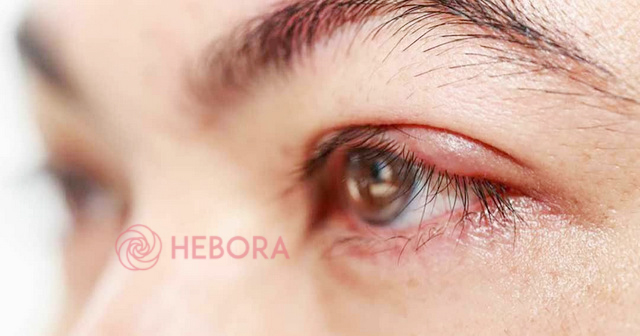 Khi mắt có dấu hiệu bất thường, bạn cần đi kiểm tra và điều trị sớm nhất