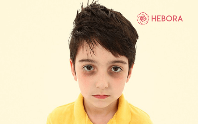 Trẻ em bị quầng mắt thâm đen bệnh gì?