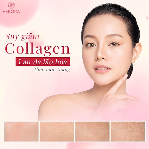 Đóng vai trò quan trọng trong cơ thể, collagen suy giảm có thể gây ra nhiều vấn đề về da